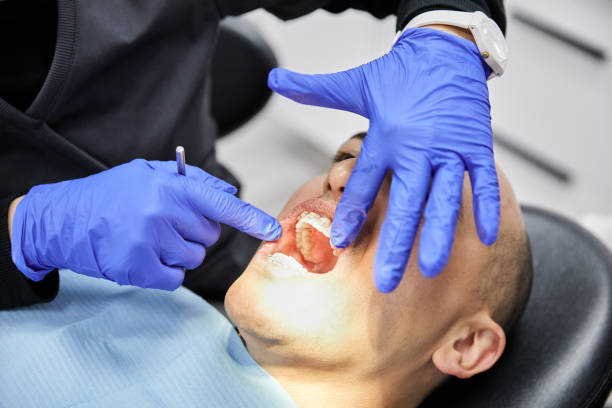 Best Knocked-Out Tooth (Avulsed Tooth) Treatment in Nassau Village Ratliff, FL